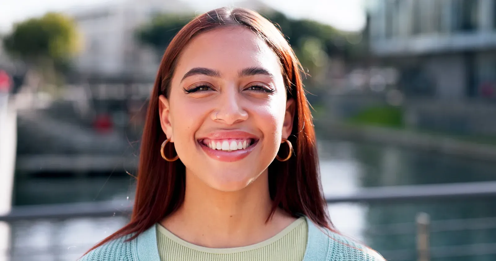 Dental Veneers at Flossophy Dental Studio Matthew